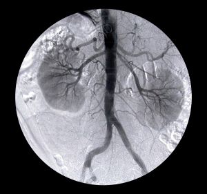 arteriography-391479-m.jpg