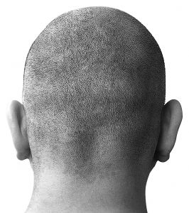 baldhead.jpg